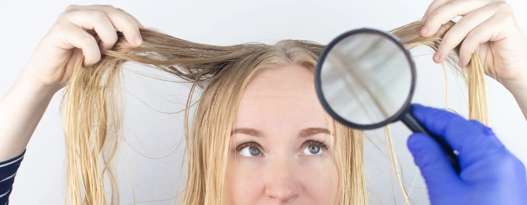 fettige Haare